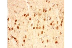 IHC-P testing of mouse brain tissue (BDNF anticorps  (AA 129-247))