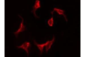 ABIN6275229 staining HeLa by IF/ICC. (MGST1 anticorps  (Internal Region))