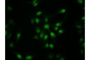 Immunofluorescent staining of HeLa cells using anti-KRT19 mouse monoclonal antibody (ABIN2452318). (Cytokeratin 19 anticorps  (AA 240-390))