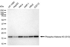 Western blotting analysis using Phospho-Histone H3 (S10) antibody (ABIN7798975).