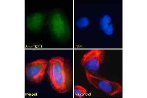 ABIN185179 Immunofluorescence analysis of paraformaldehyde fixed U2OS cells, permeabilized with 0. (TIGD1 anticorps  (C-Term))