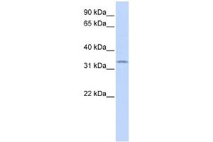 WB Suggested Anti-SOX1 Antibody Titration: 0.