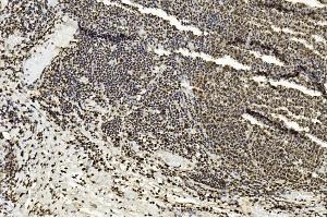 Immunohistochemical analysis of paraffin-embedded Human tonsil section using Pink1 am1836a. (EZH2 anticorps)