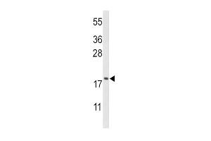 Western blot analysis of CFL1 Antibody (Center) (ABIN650759 and ABIN2839516) in HL-60 cell line lysates (35 μg/lane). (Cofilin anticorps  (AA 70-98))