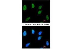 ICC/IF Image Immunofluorescence analysis of paraformaldehyde-fixed HeLa, using RAD54B, antibody at 1:100 dilution.