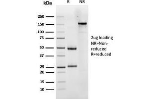SDS-PAGE Analysis Purified LHCGR Mouse Monoclonal Antibody (LHCGR/1417). (LHCGR anticorps  (AA 70-410))