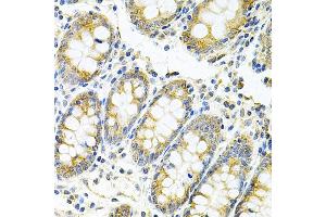 Immunohistochemistry of paraffin-embedded human colon using MyD88 Antibody (ABIN6128257, ABIN6144228, ABIN6144229 and ABIN6213986) at dilution of 1:100 (40x lens). (MYD88 anticorps  (AA 60-309))