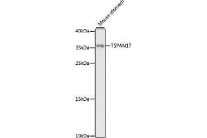 anti-Tetraspanin 17 (TSPAN17) (AA 116-234) antibody