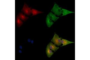 ABIN6256934 and ABIN6274825 staining  cells by IF/ICC.