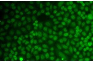 Immunofluorescence analysis of A549 cells using GADD45A Polyclonal Antibody (GADD45A anticorps)