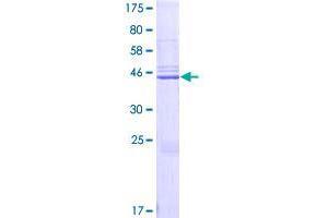 Image no. 1 for Calcyphosine-Like (CAPSL) (AA 1-198) protein (GST tag) (ABIN1348018)