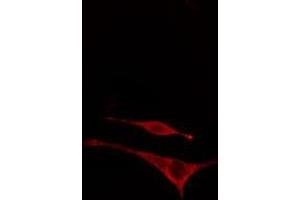 ABIN6277948 staining  NIH-3T3 cells by IF/ICC. (MAP2K7 anticorps  (pThr275))