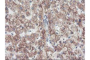Immunohistochemical staining of paraffin-embedded Human liver tissue using anti-CYP2J2 mouse monoclonal antibody. (CYP2J2 anticorps)