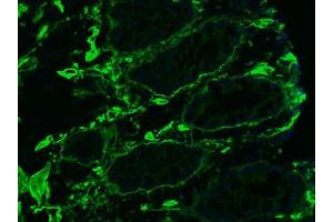 Image no. 1 for anti-Collagen, Type IV (COL4) antibody (ABIN959465) (Collagen IV anticorps)