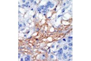 Image no. 2 for anti-Phosphatidylinositol-4-Phosphate 5-Kinase, Type I, gamma (PIP5K1C) (C-Term) antibody (ABIN360481)
