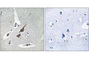 Immunohistochemistry analysis of paraffin-embedded human brain tissue, using GRID1 Antibody. (GRID1 anticorps  (AA 831-880))