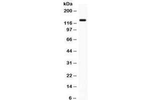 Western blot testing of human SW620 cell lysate with CDCP1 antibody. (CDCP1 anticorps)