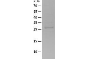 Western Blotting (WB) image for DCN1, Defective in Cullin Neddylation 1, Domain Containing 2 (DCUN1D2) (AA 1-259) protein (His-IF2DI Tag) (ABIN7122600)