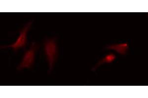 ABIN6268783 staining HepG2 by IF/ICC.