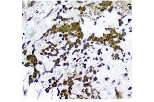 IHC analysis of NMI using anti-NMI antibody (ABIN3043451). (NMI anticorps  (AA 2-307))