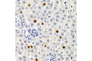 Immunohistochemistry of paraffin-embedded rat liver using GEMIN2 Antibody. (SIP1 anticorps)