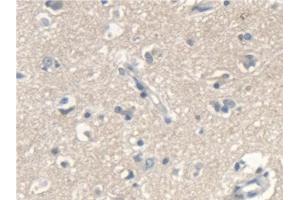 Detection of SCARA5 in Human Cerebrum Tissue using Polyclonal Antibody to Scavenger Receptor Class A Member 5 (SCARA5) (SCARA5 anticorps  (AA 118-495))