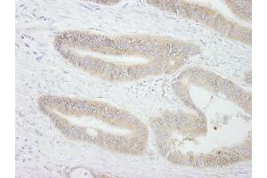 Immunohistochemistry (IHC) image for anti-Protein Tyrosine Phosphatase G1 (PTPN12) (AA 760-780) antibody (ABIN7449005)