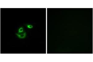 Immunofluorescence analysis of A549 cells, using CLCC1 Antibody. (CLCC1 anticorps  (AA 391-440))