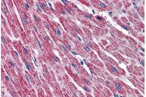 Human Heart: Formalin-Fixed, Paraffin-Embedded (FFPE)