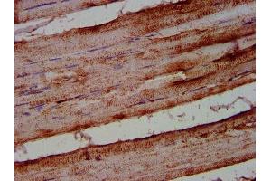 IHC image of ABIN7144528 diluted at 1:500 and staining in paraffin-embedded human skeletal muscle tissue performed on a Leica BondTM system.