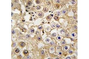 IHC analysis of FFPE human testis tissue stained with Angiotensin-converting enzyme 2 antibody (ACE2 anticorps  (AA 773-805))