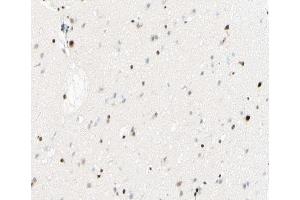 ABIN6267431 at 1/100 staining human brain tissue sections by IHC-P. (NFKB1 anticorps  (pSer893))