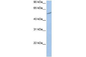WB Suggested Anti-RIOK3 Antibody Titration:  0. (RIOK3 anticorps  (C-Term))