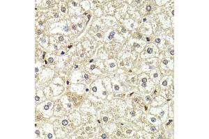 Immunohistochemistry of paraffin-embedded human liver injury using LMNB2 Antibody (ABIN5973877) at dilution of 1/200 (40x lens). (Lamin B2 anticorps)