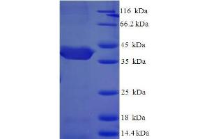 SDS-PAGE (SDS) image for CUE Domain Containing 2 (CUEDC2) (AA 1-226), (partial) protein (His-SUMO Tag) (ABIN5711911)