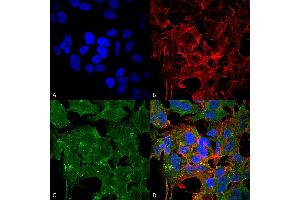 Immunocytochemistry/Immunofluorescence analysis using Mouse Anti-GluN2A/NR2A Monoclonal Antibody, Clone S327A-38 . (NMDAR2A anticorps  (AA 75-325) (Atto 594))