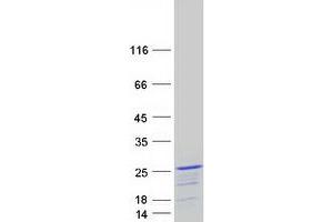 Validation with Western Blot