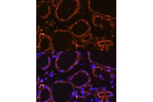 Immunofluorescence analysis of Mouse thyroid using WNT5A Rabbit pAb (ABIN6134458, ABIN6150248, ABIN6150249 and ABIN6216485) at dilution of 1:100. (WNT5A anticorps  (AA 250-350))