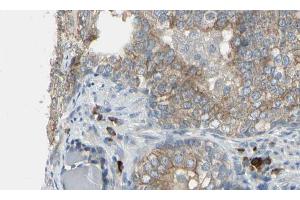 ABIN6274616 at 1/100 staining Human prostate tissue by IHC-P. (CDCA3 anticorps  (C-Term))