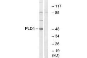 Western blot analysis of extracts from Jurkat cells, using PLD4 Antibody. (Phospholipase D4 anticorps  (AA 457-506))