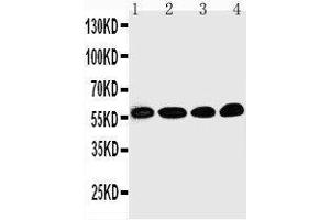 Anti-Egr1 antibody, Western blotting Lane 1: Rat Brain Tissue Lysate Lane 2: HELA Cell Lysate Lane 3: MCF-7 Cell Lysate Lane 4: COLO320 Cell Lysate