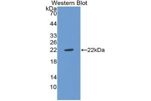 Detection of Recombinant vWF, Rat using Polyclonal Antibody to Von Willebrand Factor (vWF)