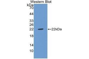 Detection of Recombinant vWF, Rat using Polyclonal Antibody to Von Willebrand Factor (vWF) (VWF anticorps  (AA 49-230))