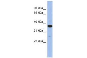 Image no. 1 for anti-Myeloid Differentiation Primary Response Gene (88) (MYD88) (AA 215-264) antibody (ABIN6744059) (MYD88 anticorps  (AA 215-264))