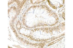 Immunohistochemistry (IHC) image for anti-Glyceraldehyde-3-Phosphate Dehydrogenase (GAPDH) (AA 150-200) antibody (ABIN7454519)