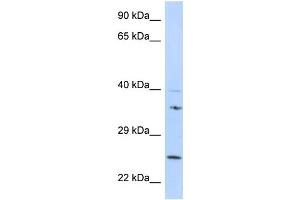 GRB2 Antibody - N-terminal region (ARP58474_P050) validated by WB using 721_B cell Lysate at 1 µg/mL. (GRB2 anticorps  (N-Term))
