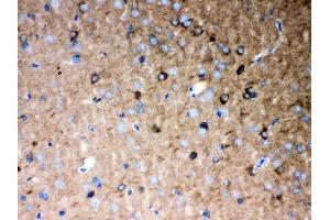 Anti- P2X5 Picoband antibody, IHC(P) IHC(P): Rat Brain Tissue