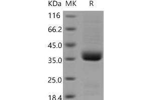 Western Blotting (WB) image for Interleukin 9 Receptor (IL9R) protein (His tag) (ABIN7321224)