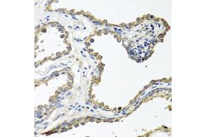 Immunohistochemistry of paraffin-embedded human prostate using COLEC11 antibody (ABIN6130117, ABIN6138854, ABIN6138855 and ABIN6220812) at dilution of 1:100 (40x lens). (COLEC11 anticorps  (AA 26-271))