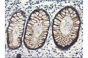 Immunohistochemical staining of paraffin-embedded Human colon tissue using anti-NAPEPLD mouse monoclonal antibody. (NAPEPLD anticorps)